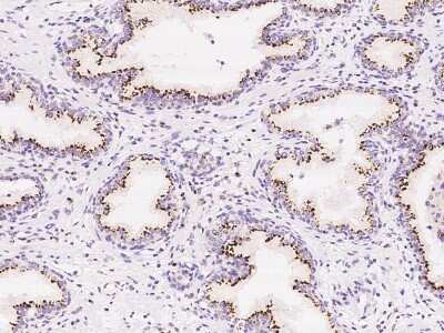 Immunohistochemistry-Paraffin: TM9SF2 Antibody [NBP2-98514]