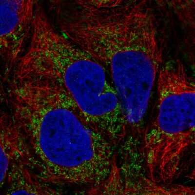 Immunocytochemistry/ Immunofluorescence: TM9SF4 Antibody [NBP2-32382]