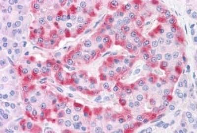 Immunohistochemistry-Paraffin: TM9SF4 Antibody [NBP3-14499]