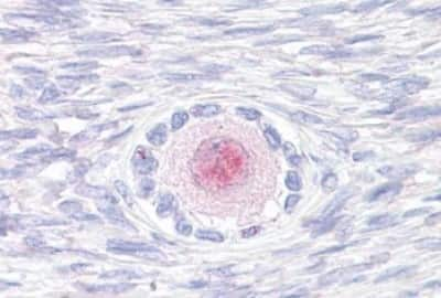 Immunohistochemistry-Paraffin: TM9SF4 Antibody [NBP3-14499]