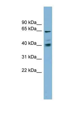 Western Blot: TM9SF4 Antibody [NBP1-59965]