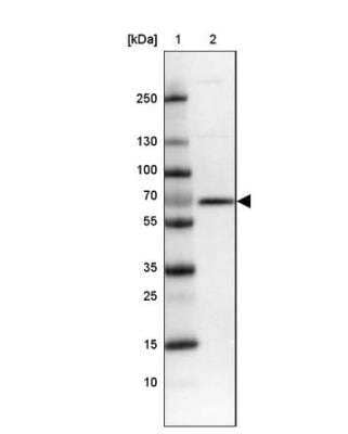 Western Blot: TM9SF4 Antibody [NBP2-32382]