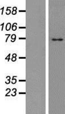 Western Blot: TM9SF4 Overexpression Lysate [NBP2-07280]