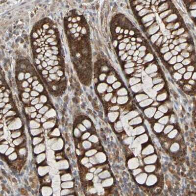 Immunohistochemistry-Paraffin: TMBIM1 Antibody [NBP1-81310]