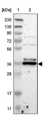 Western Blot: TMBIM1 Antibody [NBP1-81310]