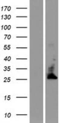 Western Blot: TMBIM4 Overexpression Lysate [NBP2-07095]