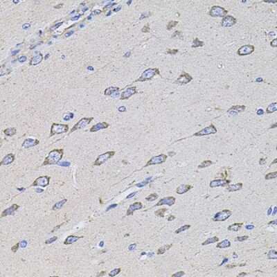 Immunohistochemistry-Paraffin: TMC1 Antibody - BSA Free [NBP3-05608]