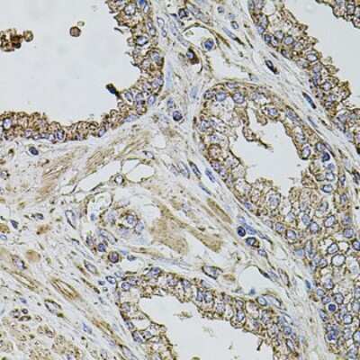 Immunohistochemistry-Paraffin: TMC1 Antibody - BSA Free [NBP3-05608]