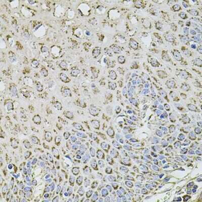 Immunohistochemistry-Paraffin: TMC1 Antibody - BSA Free [NBP3-05608]