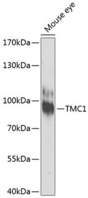 Western Blot: TMC1 AntibodyBSA Free [NBP3-05608]