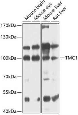 Western Blot: TMC1 AntibodyBSA Free [NBP3-05609]