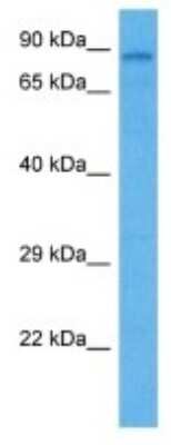 Western Blot: TMC1 Antibody [NBP3-11011]