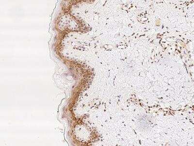 Immunohistochemistry-Paraffin: TMC2 Antibody [NBP3-05863]