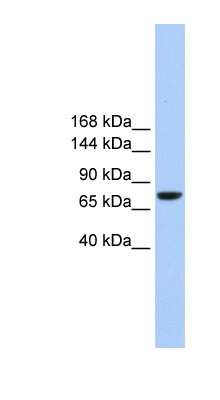 Western Blot: TMC2 Antibody [NBP1-59417]