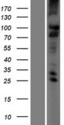 Western Blot: TMC2 Overexpression Lysate [NBP2-05763]