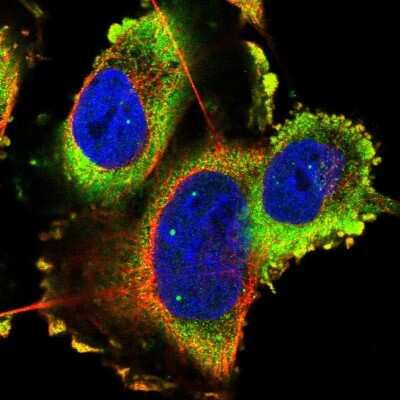 Immunocytochemistry/ Immunofluorescence: TMC3 Antibody [NBP1-86240]