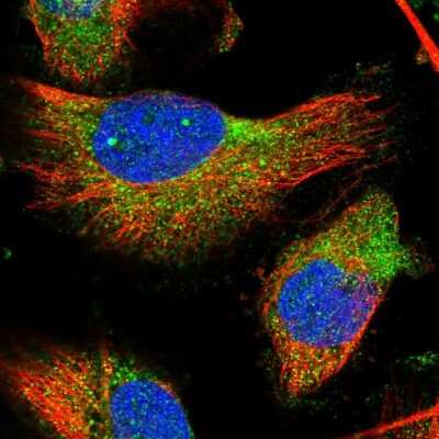 Immunocytochemistry/ Immunofluorescence: TMC3 Antibody [NBP1-86243]