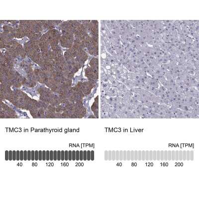 Immunohistochemistry-Paraffin: TMC3 Antibody [NBP1-86240]