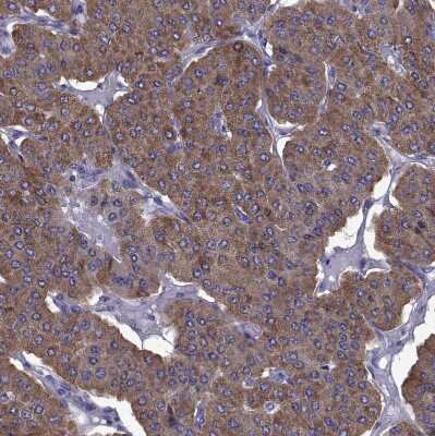 Immunohistochemistry-Paraffin: TMC3 Antibody [NBP1-86240]