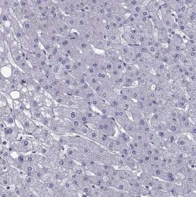 Immunohistochemistry-Paraffin: TMC3 Antibody [NBP1-86240]