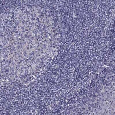 Immunohistochemistry-Paraffin: TMC3 Antibody [NBP1-86240]