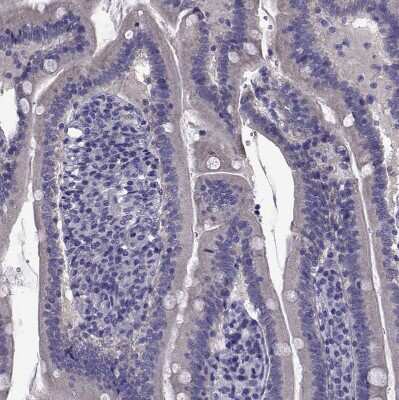Immunohistochemistry-Paraffin: TMC3 Antibody [NBP1-86240]