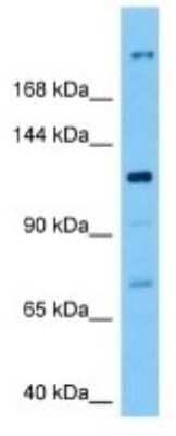 Western Blot: TMC3 Antibody [NBP3-11012]