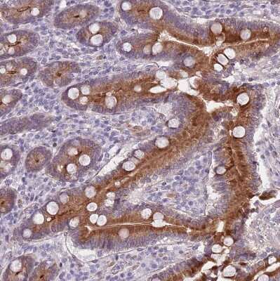 Immunohistochemistry-Paraffin: TMC4 Antibody [NBP2-13437]