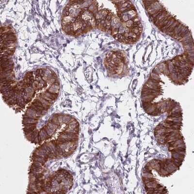 Immunohistochemistry-Paraffin: TMC4 Antibody [NBP2-13437]