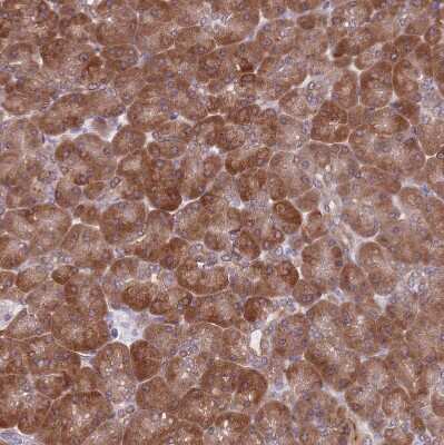 Immunohistochemistry-Paraffin: TMC4 Antibody [NBP2-13437]