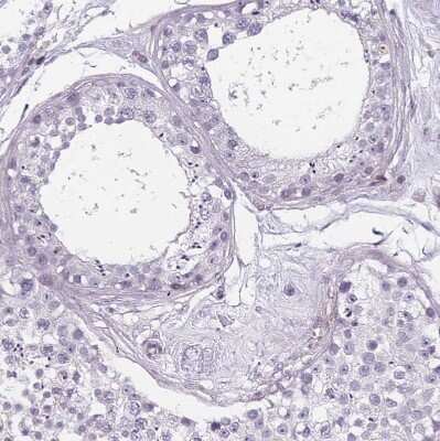 Immunohistochemistry-Paraffin: TMC4 Antibody [NBP2-13437]