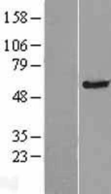 Western Blot: TMC4 Overexpression Lysate [NBP2-05549]