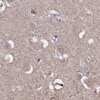 Immunohistochemistry-Paraffin: TMC5 Antibody [NBP1-83696]