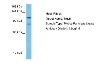 Western Blot: TMC5 Antibody [NBP2-85931]