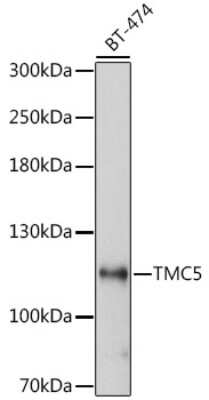 Western Blot: TMC5 AntibodyAzide and BSA Free [NBP2-93886]