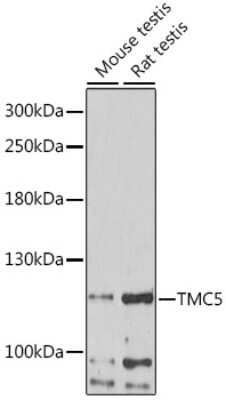 Western Blot: TMC5 AntibodyAzide and BSA Free [NBP2-93915]