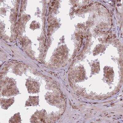 Immunohistochemistry-Paraffin: TMC6 Antibody [NBP2-13438]