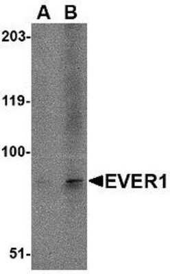 Western Blot: TMC6 AntibodyBSA Free [NBP1-76891]