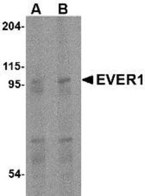 Western Blot: TMC6 AntibodyBSA Free [NBP1-76892]