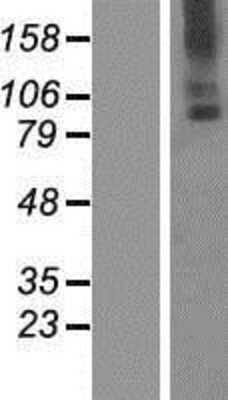 Western Blot: TMC6 Overexpression Lysate [NBP2-07512]