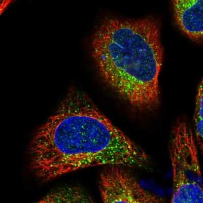 Immunocytochemistry/ Immunofluorescence: TMC7 Antibody [NBP1-83621]