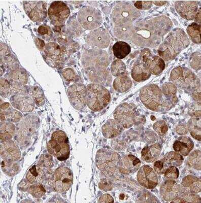 Immunohistochemistry: TMCC1 Antibody [NBP2-30463]