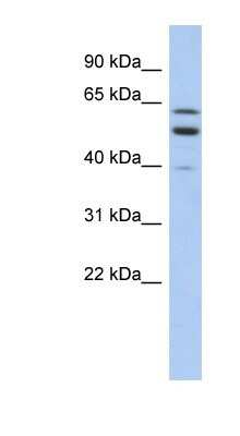 Western Blot: TMCC1 Antibody [NBP1-59917]