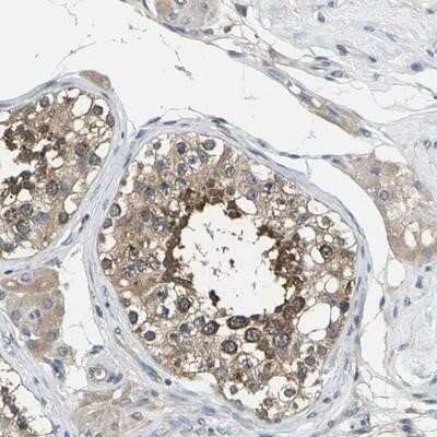 Immunohistochemistry-Paraffin: TMCC2 Antibody [NBP1-93797]
