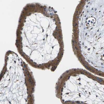 Immunohistochemistry-Paraffin: TMCC2 Antibody [NBP1-93797]