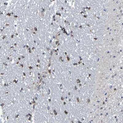 Immunohistochemistry-Paraffin: TMCC3 Antibody [NBP1-93600]