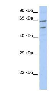 Western Blot: TMCC3 Antibody [NBP1-91338]