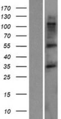 Western Blot: TMCC3 Overexpression Lysate [NBP2-06625]