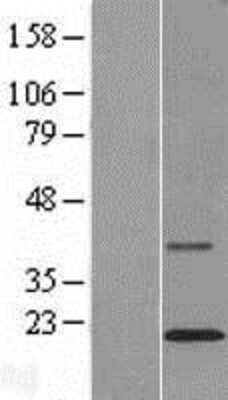 Western Blot: TMCO2 Overexpression Lysate [NBL1-16977]