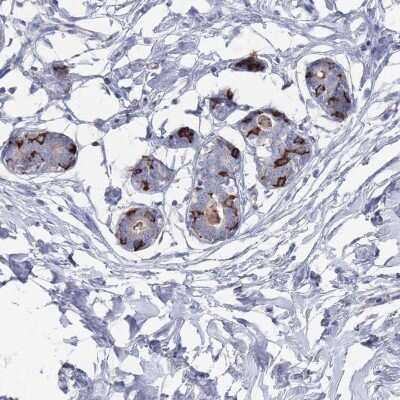 Immunohistochemistry: TMCO3 Antibody [NBP2-47603]